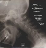 Satanic Surfers-Unconsciously Confined-LP (Vinyl)-02