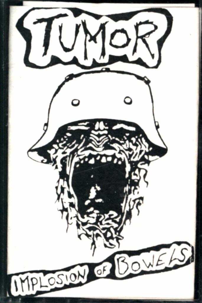 Tumor-Implosion Of Bowels-Tape-01